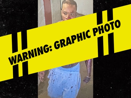 torey lanez stabbing photo WARNING tmz wm
